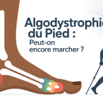 Algodystrophie pied : peut-on marcher visuel douleur et marche canne