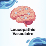 illustration cerveau leucopathie vasculaire zones blanches