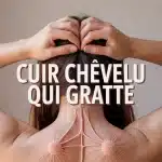 illustration cuir chevelu qui gratte avec inflammation